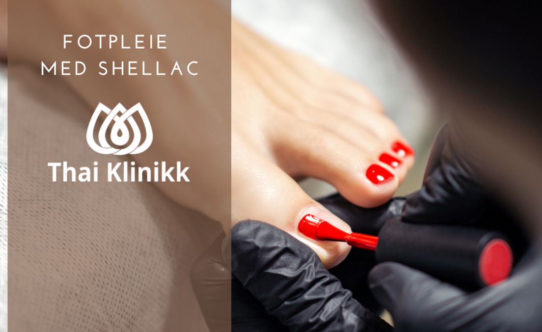 Fotpleie med Shellac
