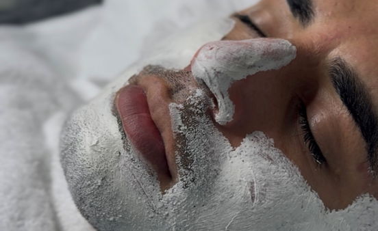 Ansiktsbehandling - Kjemisk peeling